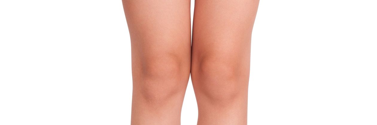 Jak leczyć koślawość kolan u dzieci?